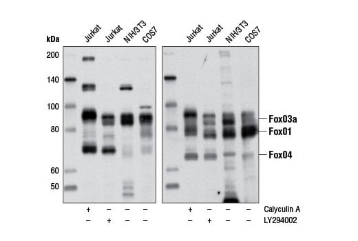 undefined Image 2: Insulin/IGF-1 Signaling Pathway Antibody Sampler Kit