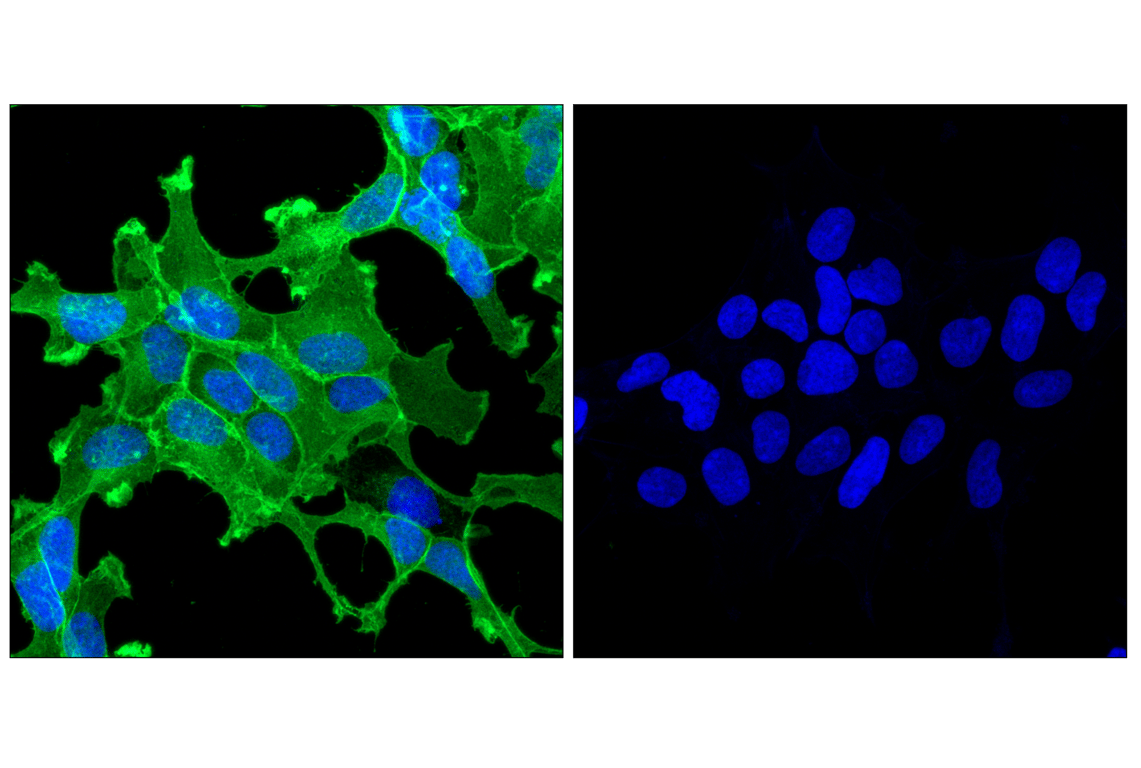 Immunofluorescence Image 1: Myc-Tag (71D10) Rabbit Monoclonal Antibody