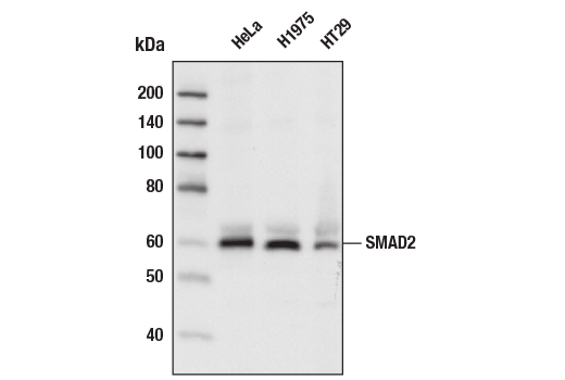 Western Blotting Image 2: SMAD2 (86F7) Rabbit Monoclonal Antibody