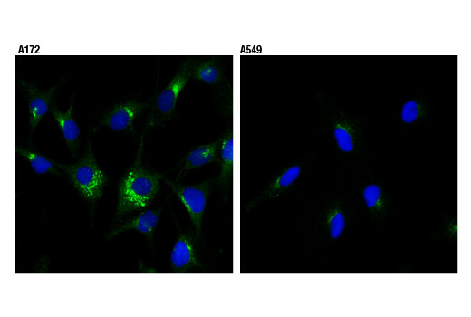 Immunofluorescence Image 1: IGF-II Receptor/CI-M6PR (D3V8C) Rabbit Monoclonal Antibody