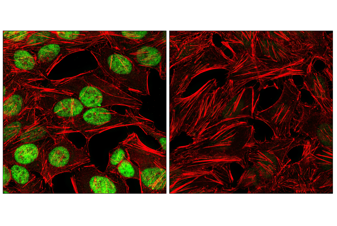 undefined Image 29: Wnt/beta-Catenin Activated Targets Antibody Sampler Kit