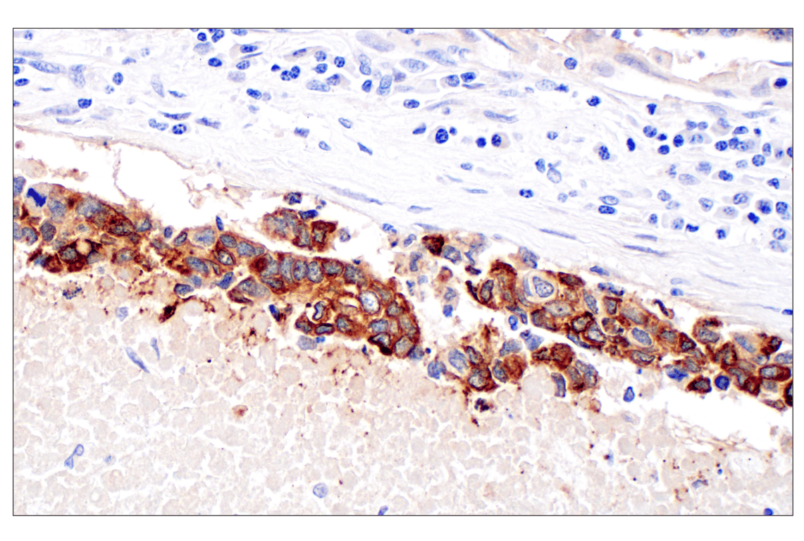Immunohistochemistry Image 1: IGFBP2 (F3E6V) Rabbit Monoclonal Antibody