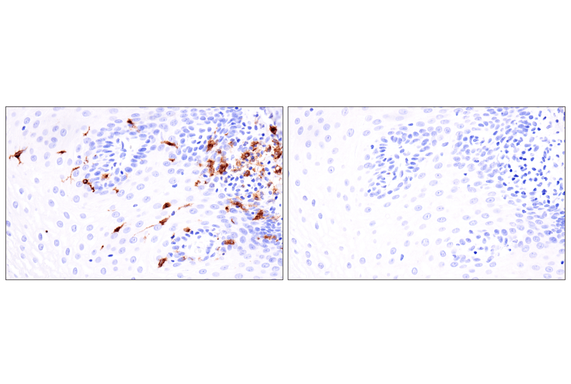 Immunohistochemistry Image 11: Langerin (F8L8I) Rabbit Monoclonal Antibody