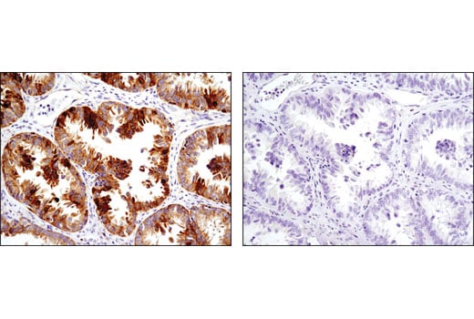 Immunohistochemistry Image 11: Cox2 (D5H5) XP<sup>®</sup> Rabbit mAb (BSA and Azide Free)