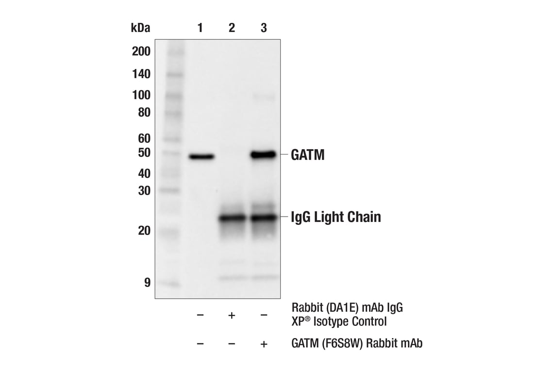 Immunoprecipitation Image 1: GATM (F6S8W) Rabbit Monoclonal Antibody