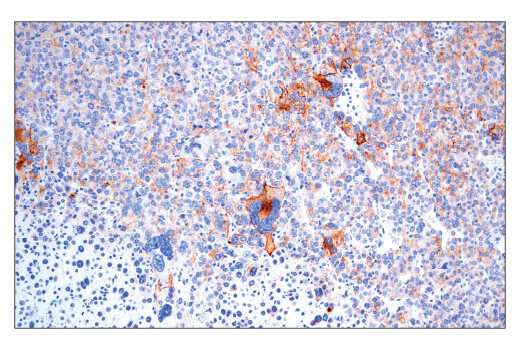 Immunohistochemistry Image 2: CD40 (E2Z7J) Rabbit Monoclonal Antibody
