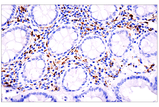 Immunohistochemistry Image 2: Calretinin (E7R6O) Rabbit Monoclonal Antibody (BSA and Azide Free)