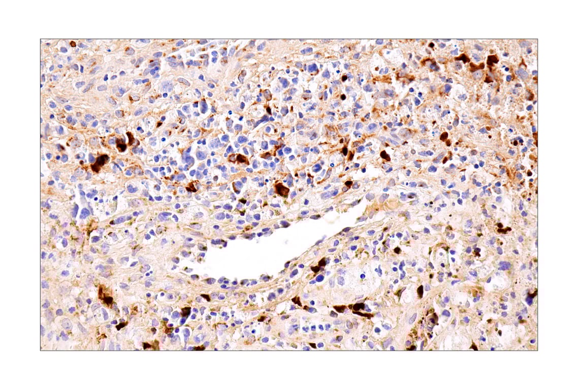 CXCL9/MIG (E6Z5W) Rabbit mAb | Cell Signaling Technology