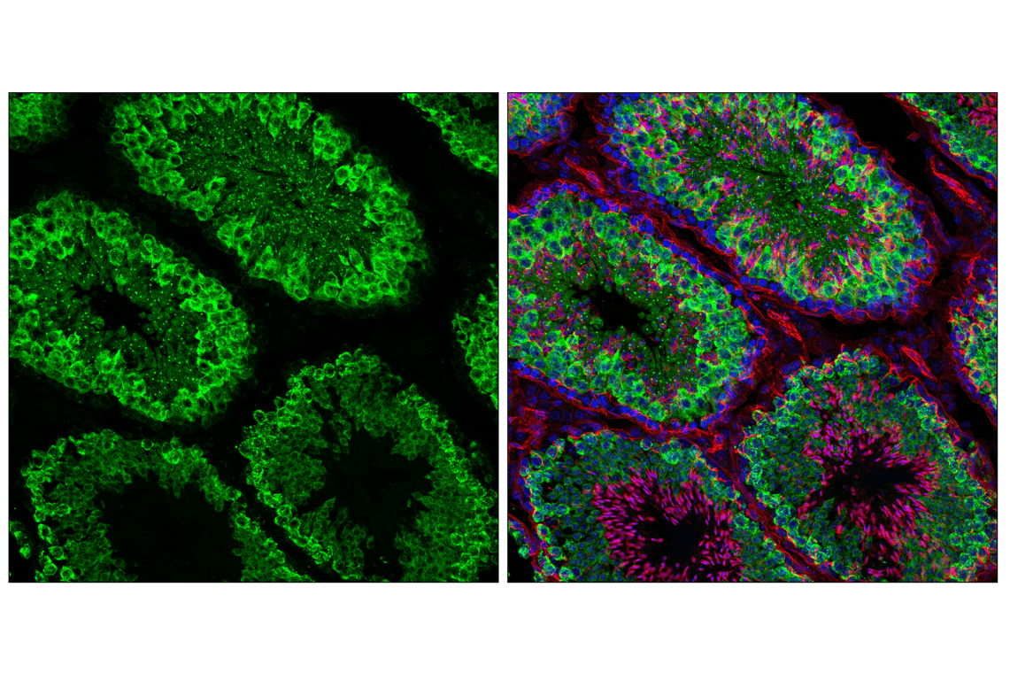 Immunofluorescence Image 2: PCM-1 (F8Q8B) Rabbit Monoclonal Antibody