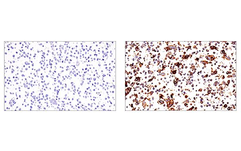 Immunohistochemistry Image 2: PD-L2 (D6L5A) Rabbit Monoclonal Antibody