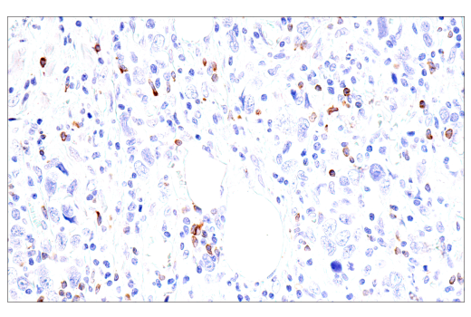 Immunohistochemistry Image 2: GNLY (E2T3D) Rabbit Monoclonal Antibody