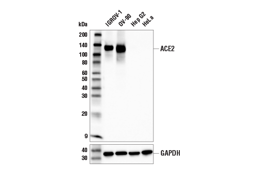 Western Blotting Image 2: ACE2 (E5O6J) Rabbit Monoclonal Antibody (BSA and Azide Free)