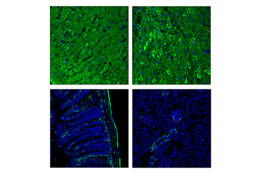 Immunofluorescence Image 1: Enolase-2 (E7D7I) Rabbit Monoclonal Antibody