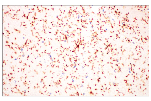 Immunohistochemistry Image 1: TMEM119 (E3W5L) Rabbit Monoclonal Antibody
