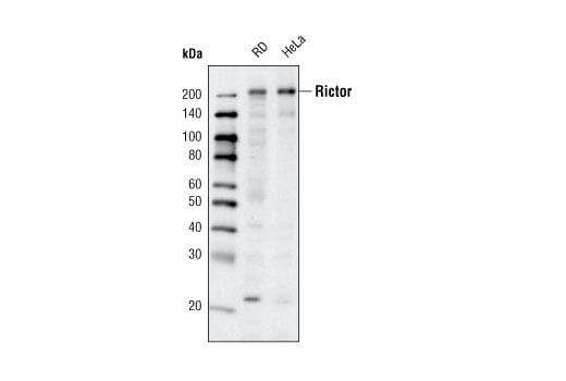 Western Blotting Image 1: Rictor (D16H9) Rabbit mAb