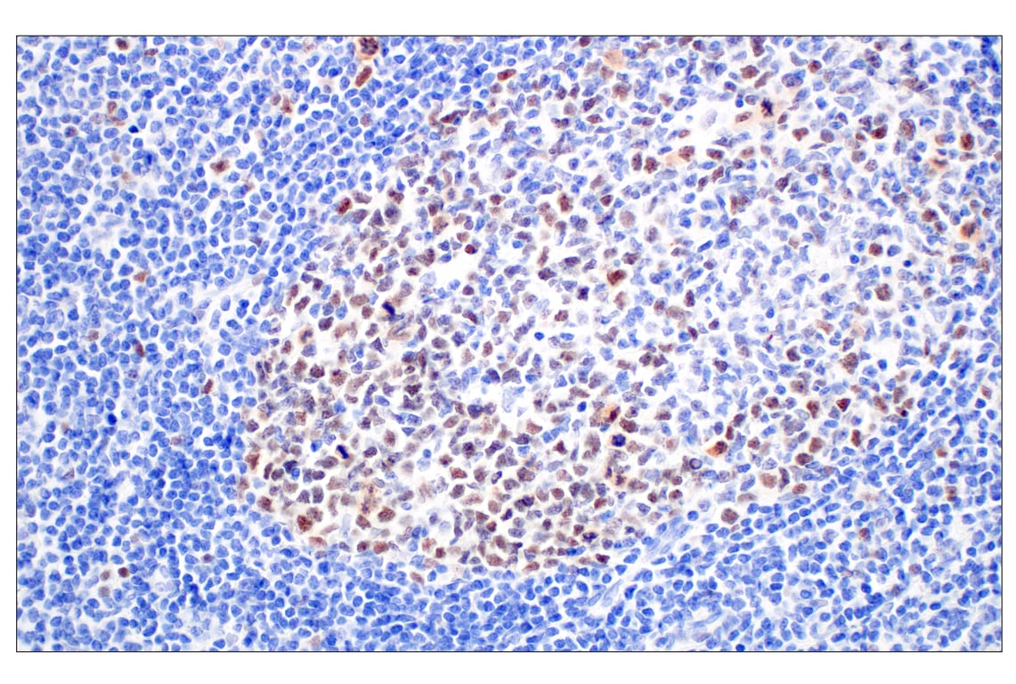 Immunohistochemistry Image 9: BRCA1 (E5S9G) Rabbit Monoclonal Antibody
