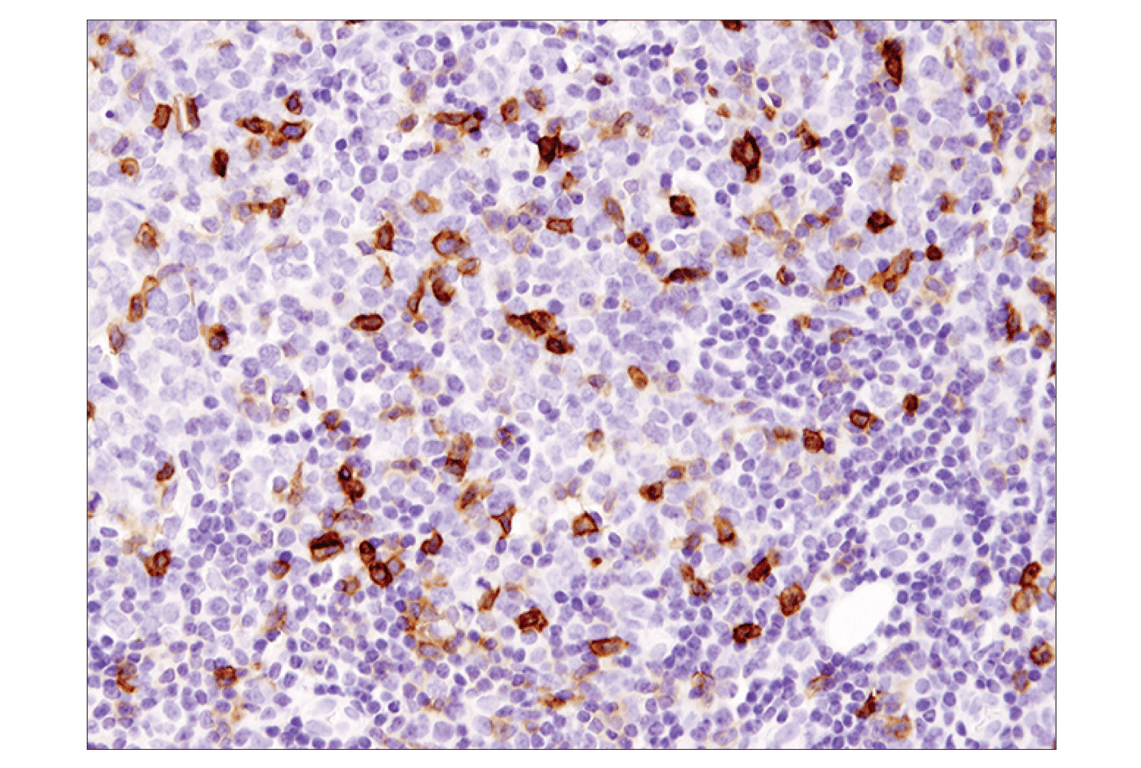 Immunohistochemistry Image 3: ICOS (D1K2T<sup>™</sup>) Rabbit Monoclonal Antibody