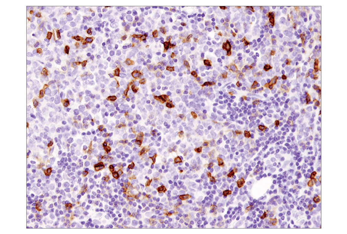 Immunohistochemistry Image 3: ICOS (D1K2T<sup>™</sup>) Rabbit mAb