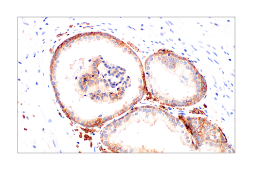 Immunohistochemistry Image 9: Glut1 (E4S6I) Rabbit Monoclonal Antibody