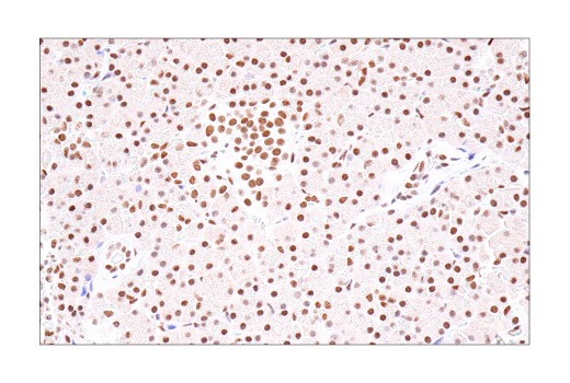 Immunohistochemistry Image 5: BRD4 (E2A7X) Rabbit Monoclonal Antibody (BSA and Azide Free)