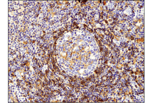 Immunohistochemistry Image 2: MTSS1 (D2H4L) Rabbit Monoclonal Antibody