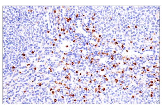 Immunohistochemistry Image 6: CEACAM6 (E7S7Y) Rabbit Monoclonal Antibody (BSA and Azide Free)