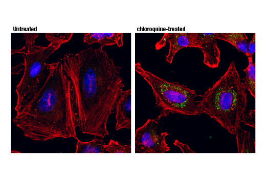 Immunofluorescence Image 1: GABARAPL1 (D5R9Y) XP<sup>®</sup> Rabbit mAb (BSA and Azide Free)