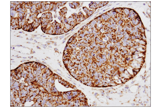 Immunohistochemistry Image 4: SLP-2 (D2I9X) Rabbit Monoclonal Antibody
