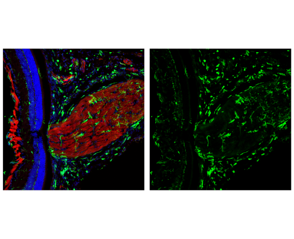 Immunofluorescence Image 2: CD45 (D3F8Q) Rabbit Monoclonal Antibody (BSA and Azide Free)