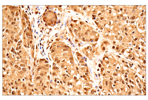 Immunohistochemistry Image 2: Ubiquitin (E6K4Y) Rabbit Monoclonal Antibody (BSA and Azide Free)