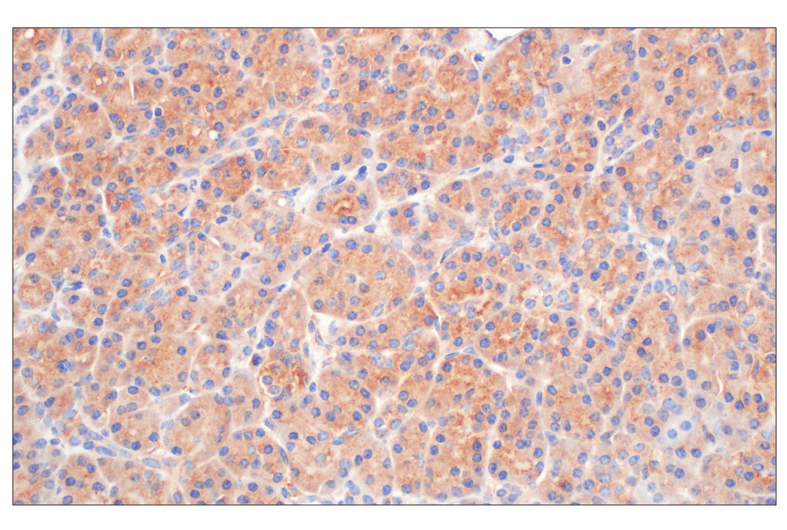 Immunohistochemistry Image 10: EEA1 (E9Q6G) Mouse Monoclonal Antibody