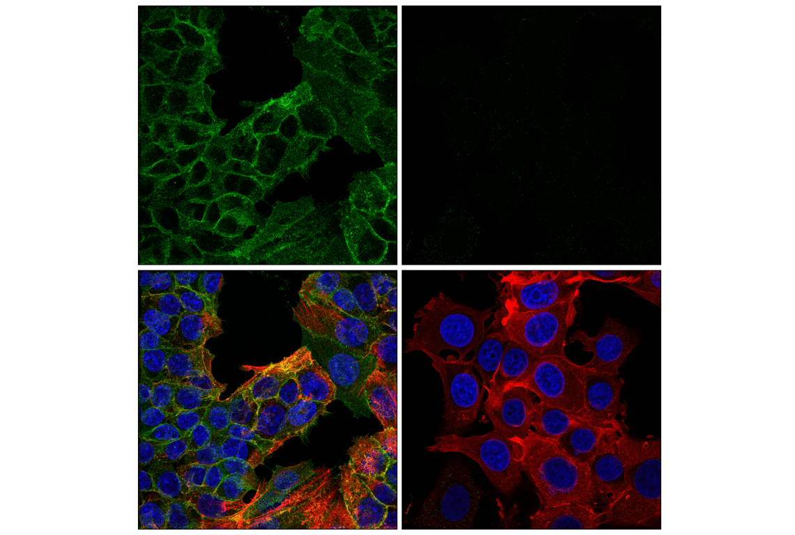 Immunofluorescence Image 1: CDCP1 (F3M9G) Rabbit Monoclonal Antibody