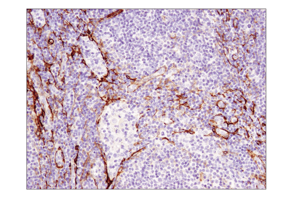 Immunohistochemistry Image 2: alpha-Smooth Muscle Actin (1A4) Mouse Monoclonal Antibody (BSA and Azide Free)