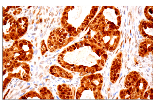 Immunohistochemistry Image 2: TAZ (E9J5A) Rabbit Monoclonal Antibody (BSA and Azide Free)