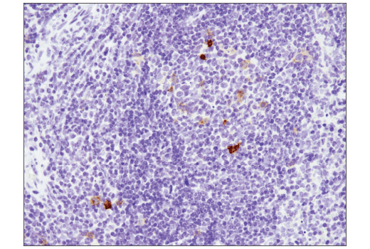 Immunohistochemistry Image 6: TNFRSF8/CD30 (E4L4I) Rabbit Monoclonal Antibody