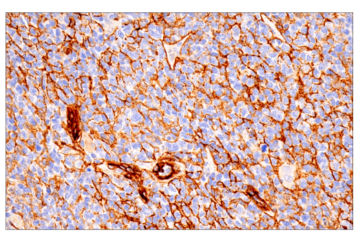 undefined Image 22: Pericyte Antibody Sampler Kit