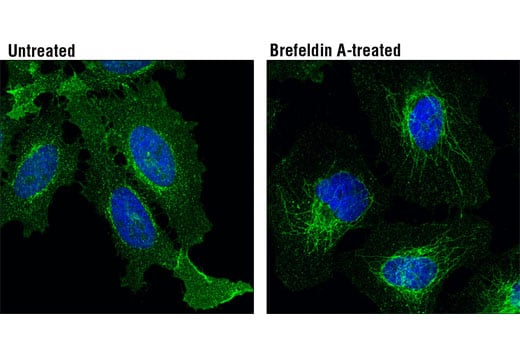 Immunofluorescence Image 1: Transferrin Receptor/CD71 (D7S5Z) Rabbit Monoclonal Antibody