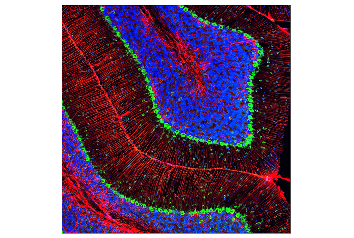 Immunofluorescence Image 1: S6 Ribosomal Protein (5G10) Rabbit Monoclonal Antibody (BSA and Azide Free)