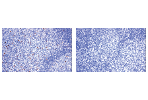 Immunohistochemistry Image 3: OX40 (ACT35) Mouse Monoclonal Antibody (BSA and Azide Free)