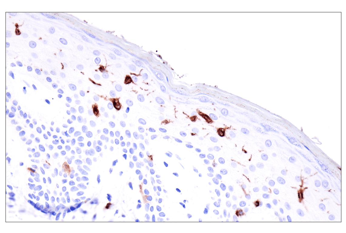 Immunohistochemistry Image 7: Langerin (F8L8I) Rabbit Monoclonal Antibody