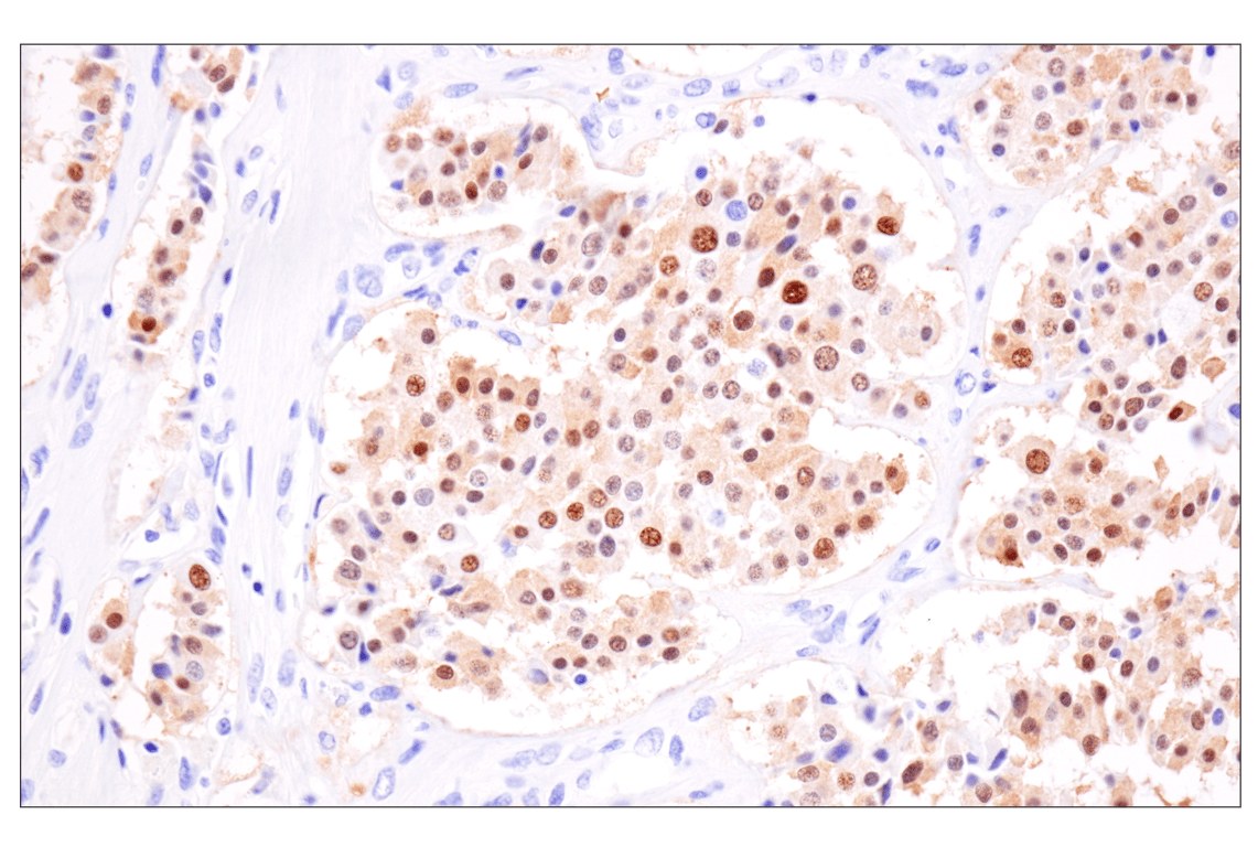 Immunohistochemistry Image 2: INSM1 (BLR272L) Rabbit Monoclonal Antibody