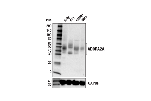 Western Blotting Image 4: ADORA2A/Adenosine Receptor A2a (E6M3W) Rabbit mAb