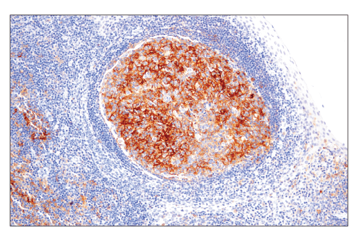 Immunohistochemistry Image 3: CD86 (E2G8P) Rabbit Monoclonal Antibody
