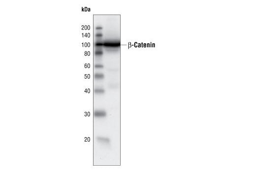 Western Blotting Image 2: beta-Catenin Antibody