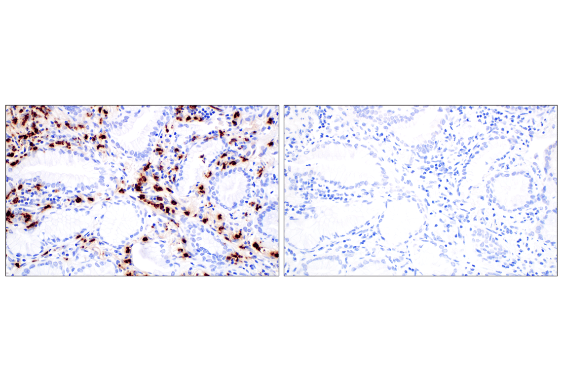Immunohistochemistry Image 10: Neutrophil Elastase (F4H3X) Rabbit Monoclonal Antibody