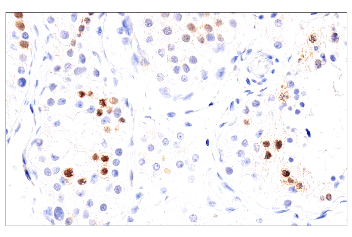 Immunohistochemistry Image 12: Chk1 (2G1D5) Mouse mAb