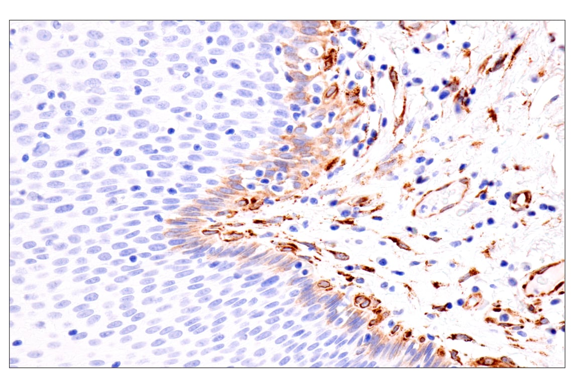 Immunohistochemistry Image 5: HSP47/SERPINH1 (E4A8P) Rabbit Monoclonal Antibody