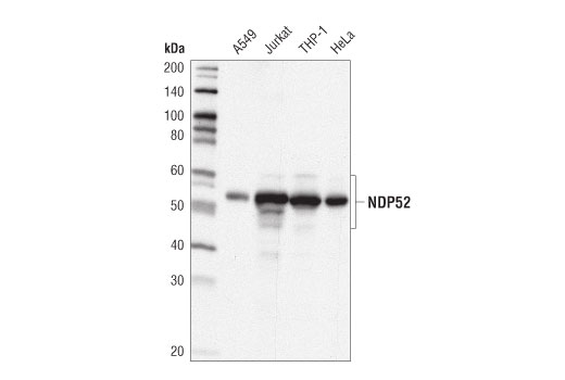 undefined Image 7: Xenophagy Antibody Sampler Kit