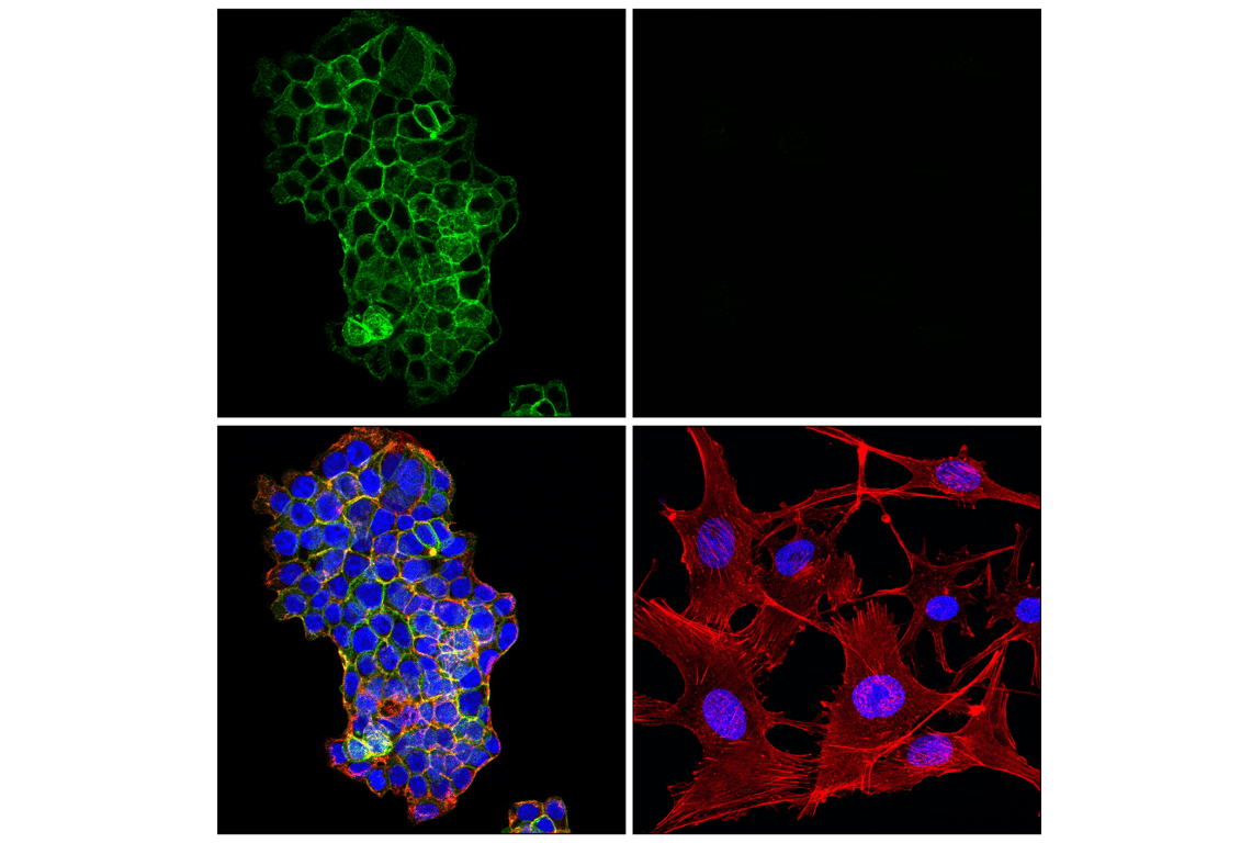 Immunofluorescence Image 1: SNAP25 (F5Z2D) Rabbit Monoclonal Antibody