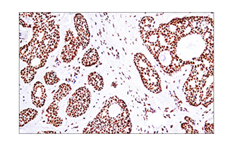 Immunohistochemistry Image 3: 53BP1 (E7N5D) Rabbit Monoclonal Antibody